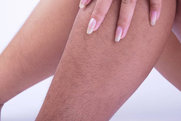 Hairy female legs. No leg shaving.